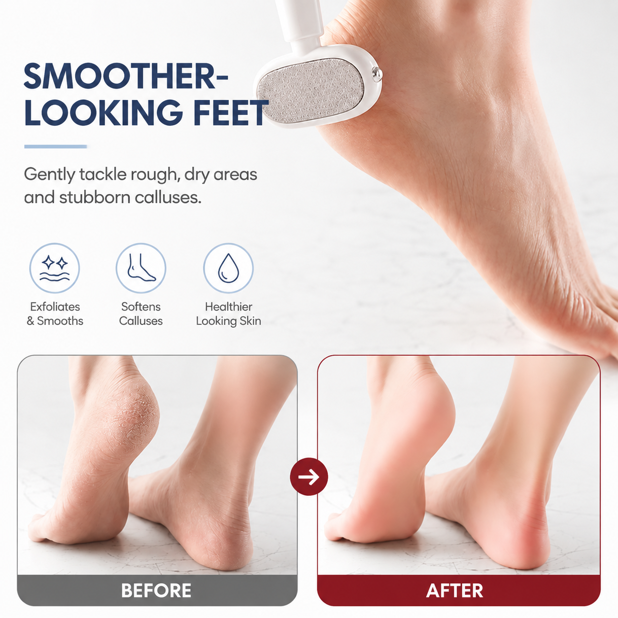 2-in-1 Foot Callus Remover – Dual-Sided Foot File with Replaceable Blade