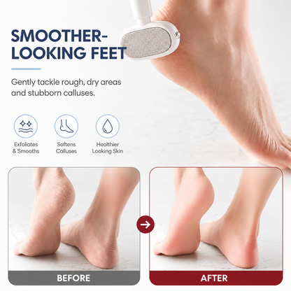 2-in-1 Foot Callus Remover – Dual-Sided Foot File with Replaceable Blade
