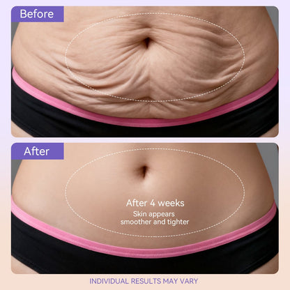 Tighten & Smooth Belly Firming Cream