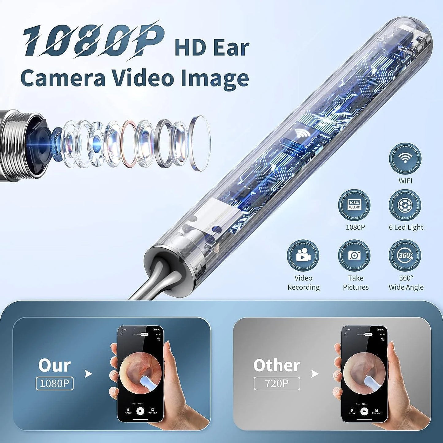 1080P HD Smart Ear Cleaner Camera - Safe ABS Visual Earwax Removal Kit with 8 Professional Tips & Certified Safety
