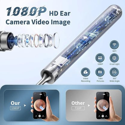 1080P HD Smart Ear Cleaner Camera - Safe ABS Visual Earwax Removal Kit with 8 Professional Tips & Certified Safety