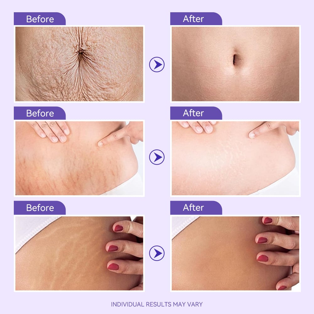 Tighten & Smooth Belly Firming Cream
