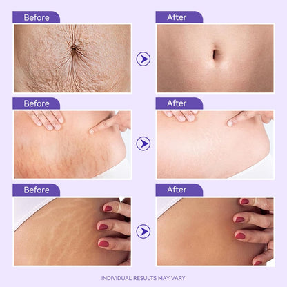 Tighten & Smooth Belly Firming Cream