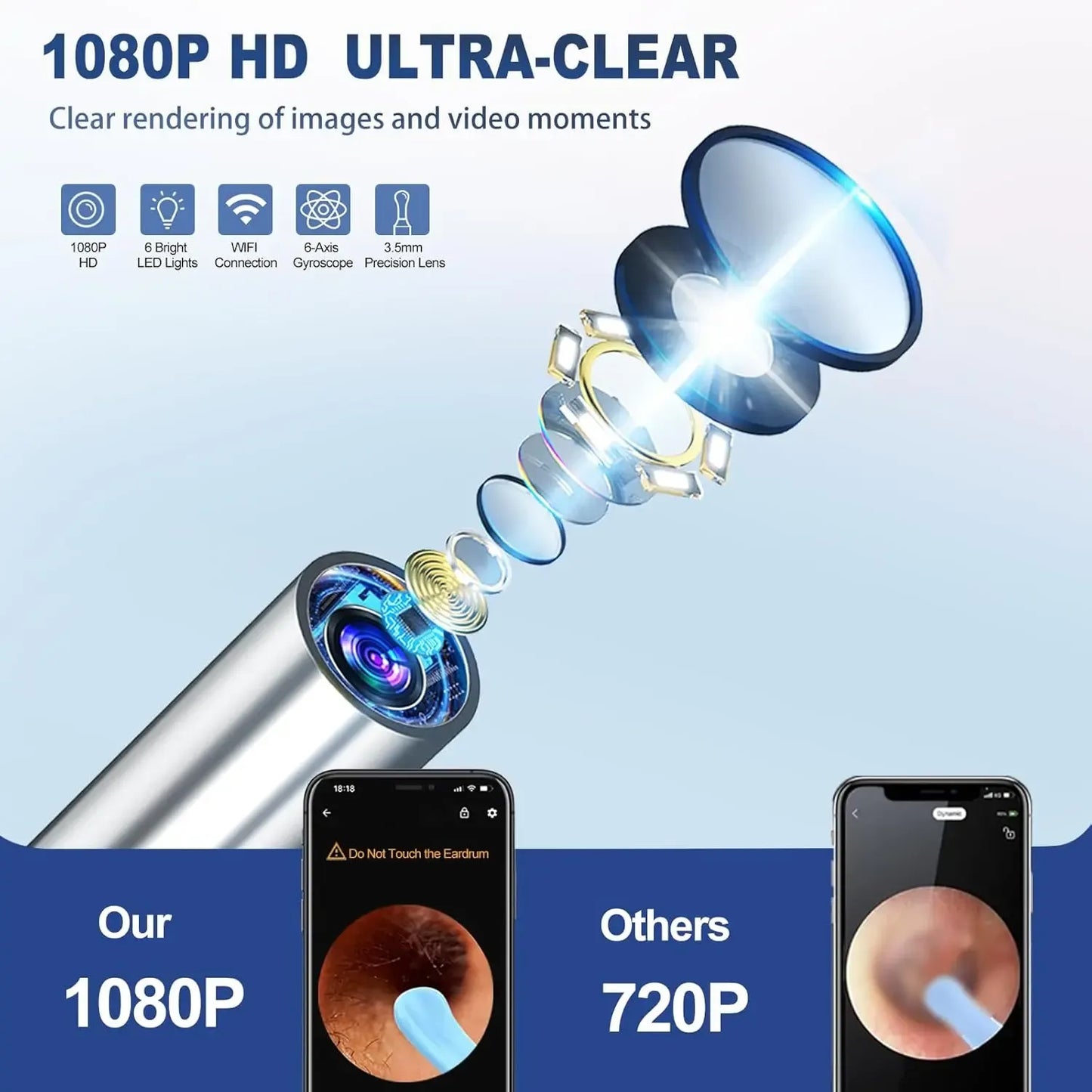 1080P HD Smart Ear Cleaner Camera - Safe ABS Visual Earwax Removal Kit with 8 Professional Tips & Certified Safety