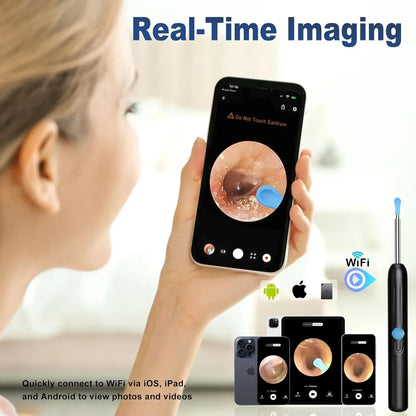 1080P HD Smart Ear Cleaner Camera - Safe ABS Visual Earwax Removal Kit with 8 Professional Tips & Certified Safety