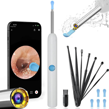 1080P HD Smart Ear Cleaner Camera - Safe ABS Visual Earwax Removal Kit with 8 Professional Tips & Certified Safety