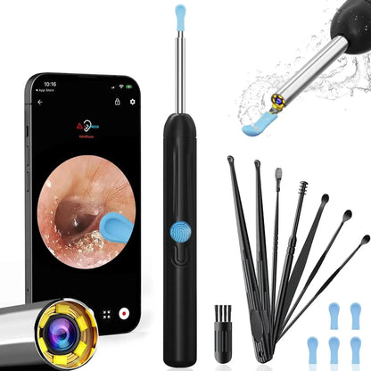 1080P HD Smart Ear Cleaner Camera - Safe ABS Visual Earwax Removal Kit with 8 Professional Tips & Certified Safety